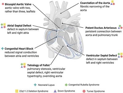 Congenital Heart Disease: An Immunological Perspective